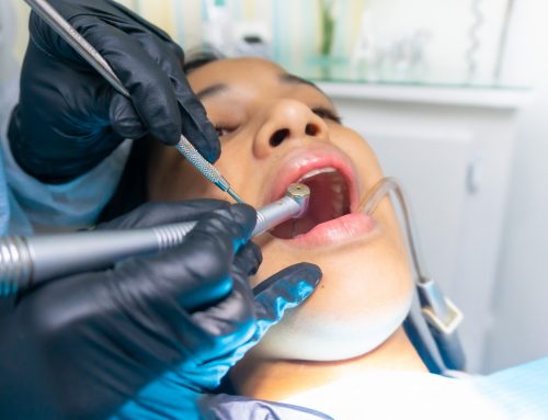 Why Should You Visit an Emergency Dentist?